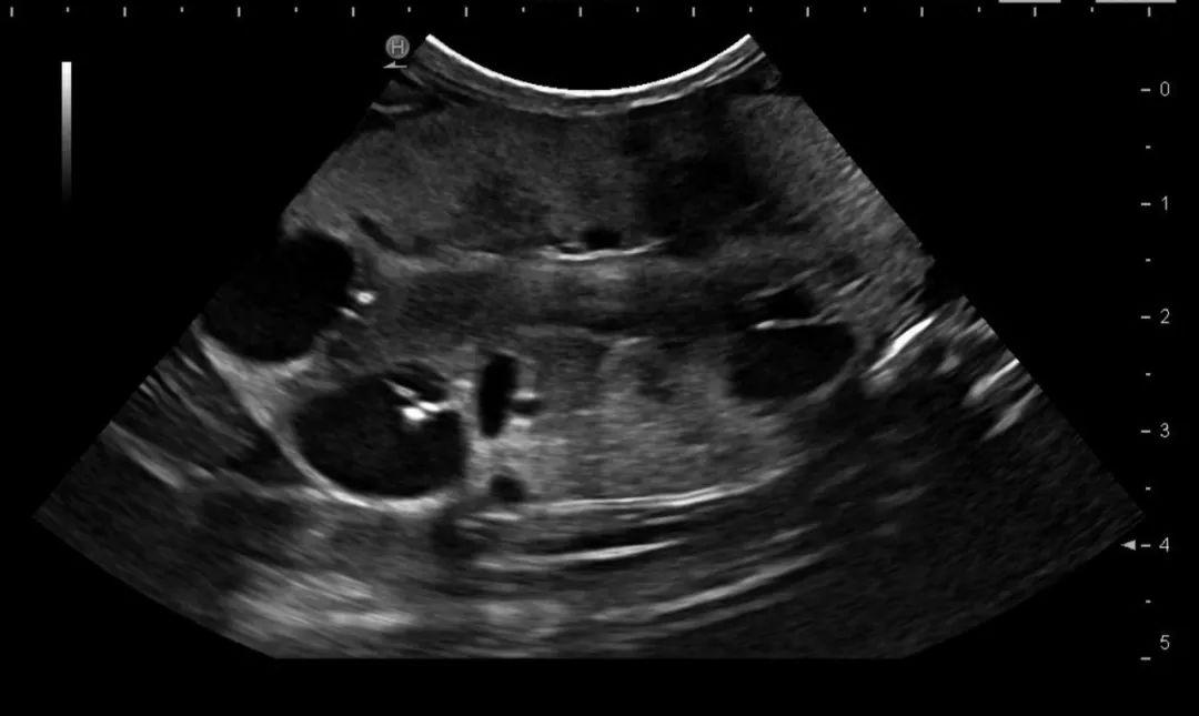 猫多囊肾最严重的后果,猫多囊肾科普