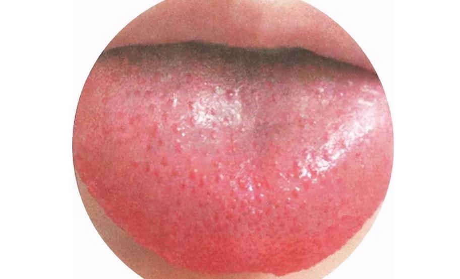 食谱止咳润肺的冰糖雪梨银耳汤,砂锅冰糖雪梨的正确做法润肺止咳