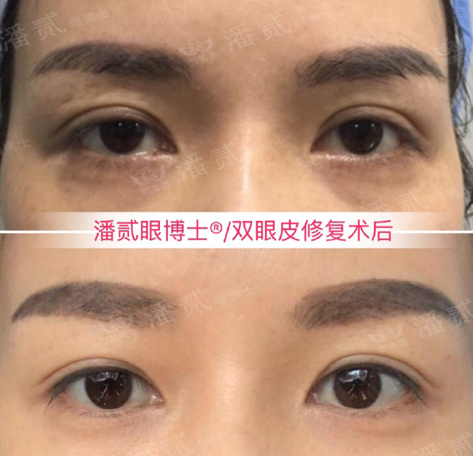 美容手术不想做了会退钱吗,美容整形不花钱