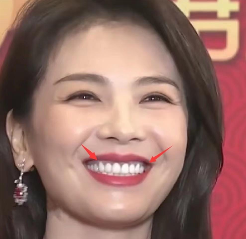 假发，假臀，假肌肉？明星“好皮囊”下，是眼见不一定为实的真相