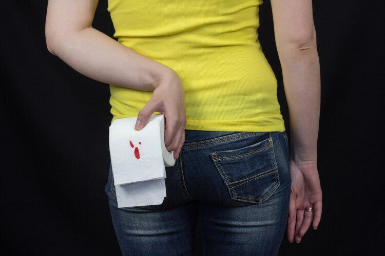 男士不注意卫生,男人不注意私人卫生