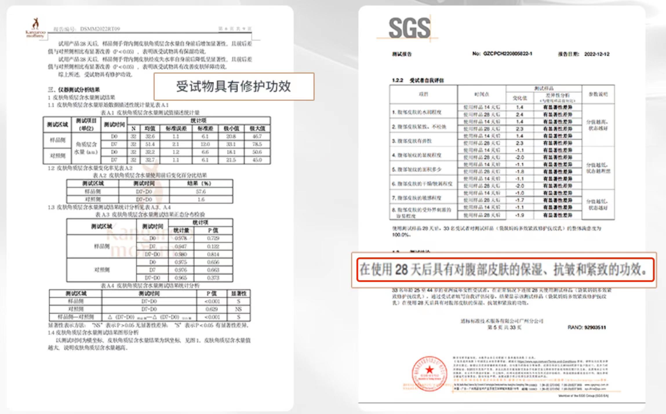 冻干粉淡斑修复妊娠纹,淡纹妊娠精华测评