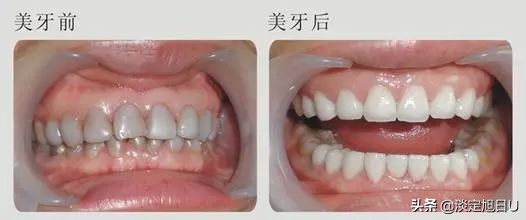 口腔牙医暴利行业,口腔行业真的是暴利行业吗