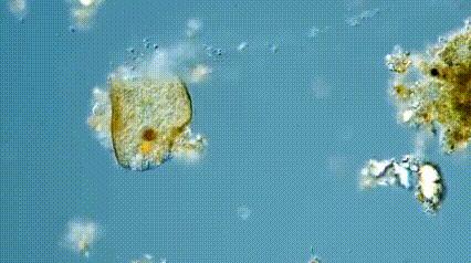 运动神经元显微镜观察内容与结果,显微镜下观察神经元的判断依据