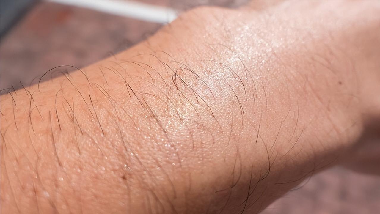 47岁女子阴毛变白和性功能有关系吗?医生:这是正常的衰老现象