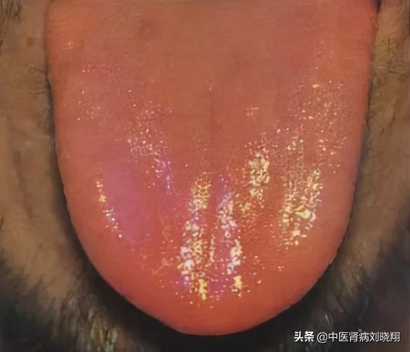 刘主任让病人伸舌头，看的是什么？