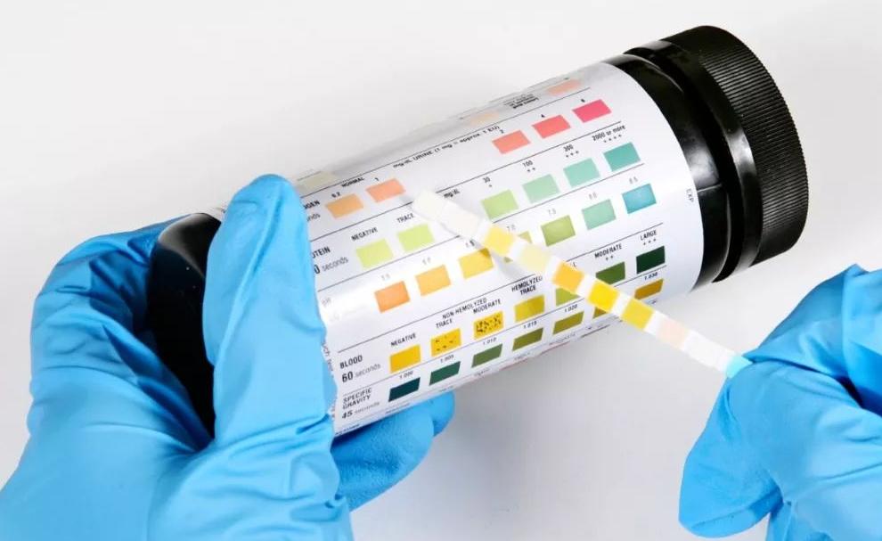 紫癜病友康复历程,紫癜肾炎复发了怎么办