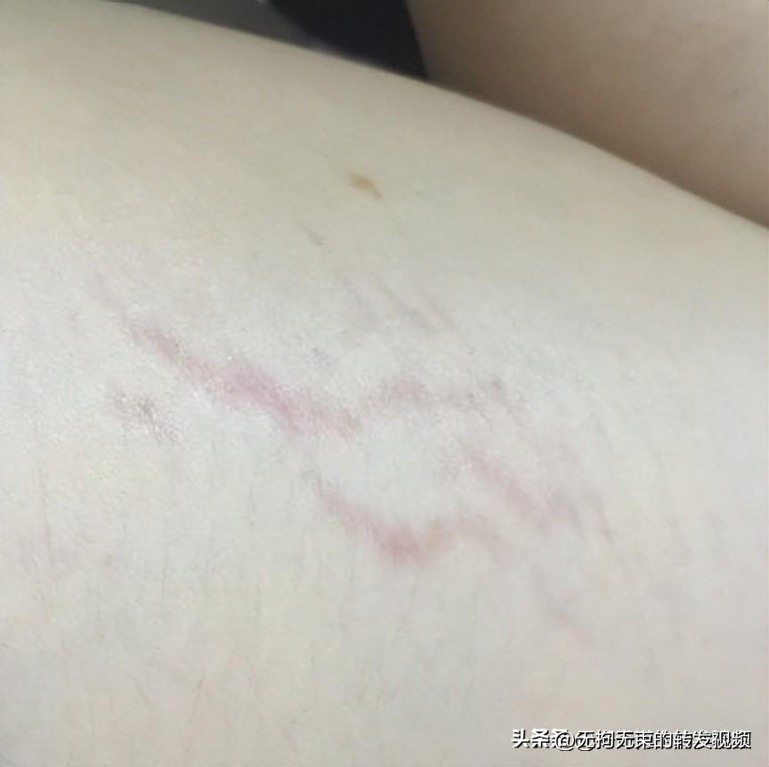 屁股上有白色条纹,屁股上都是白色条纹