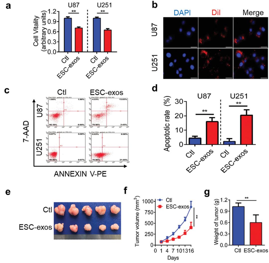 法国最新治疗胶质母细胞瘤,干细胞治疗母细胞胶质瘤