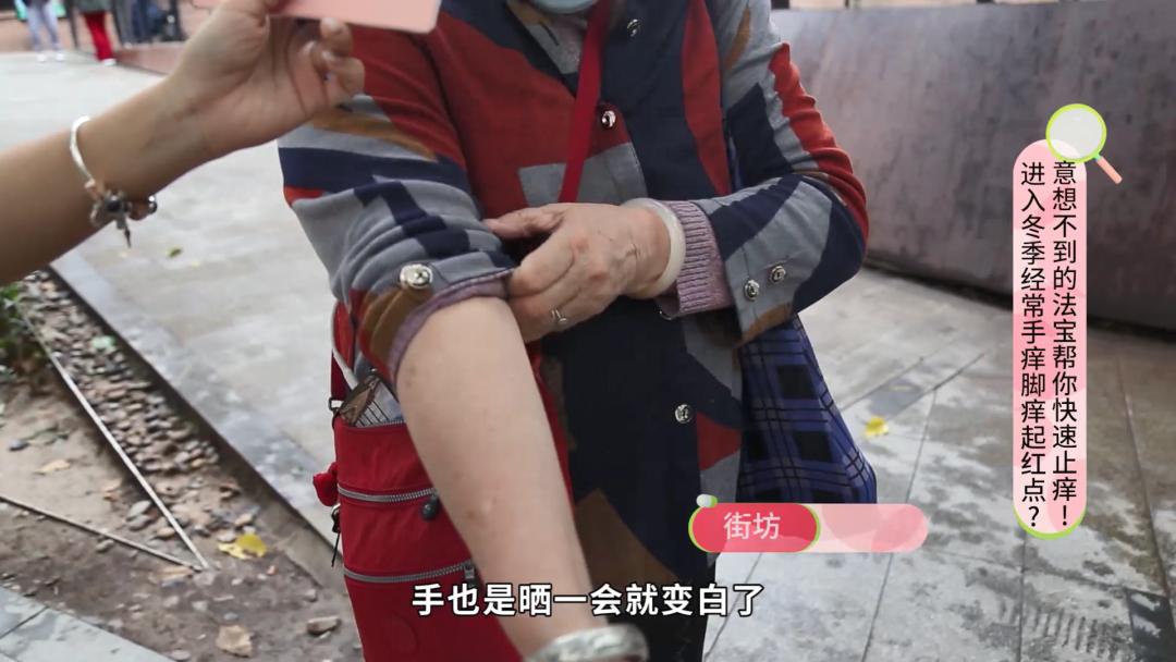 晚上手痒脚痒有红点是怎么回事,冬天脚痒快速止痒小妙招