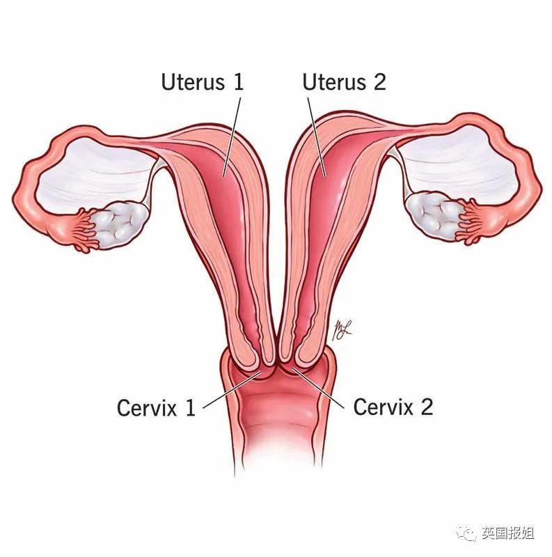 女子双子宫同时怀胎,双子宫妇女怀孕的几率有多少