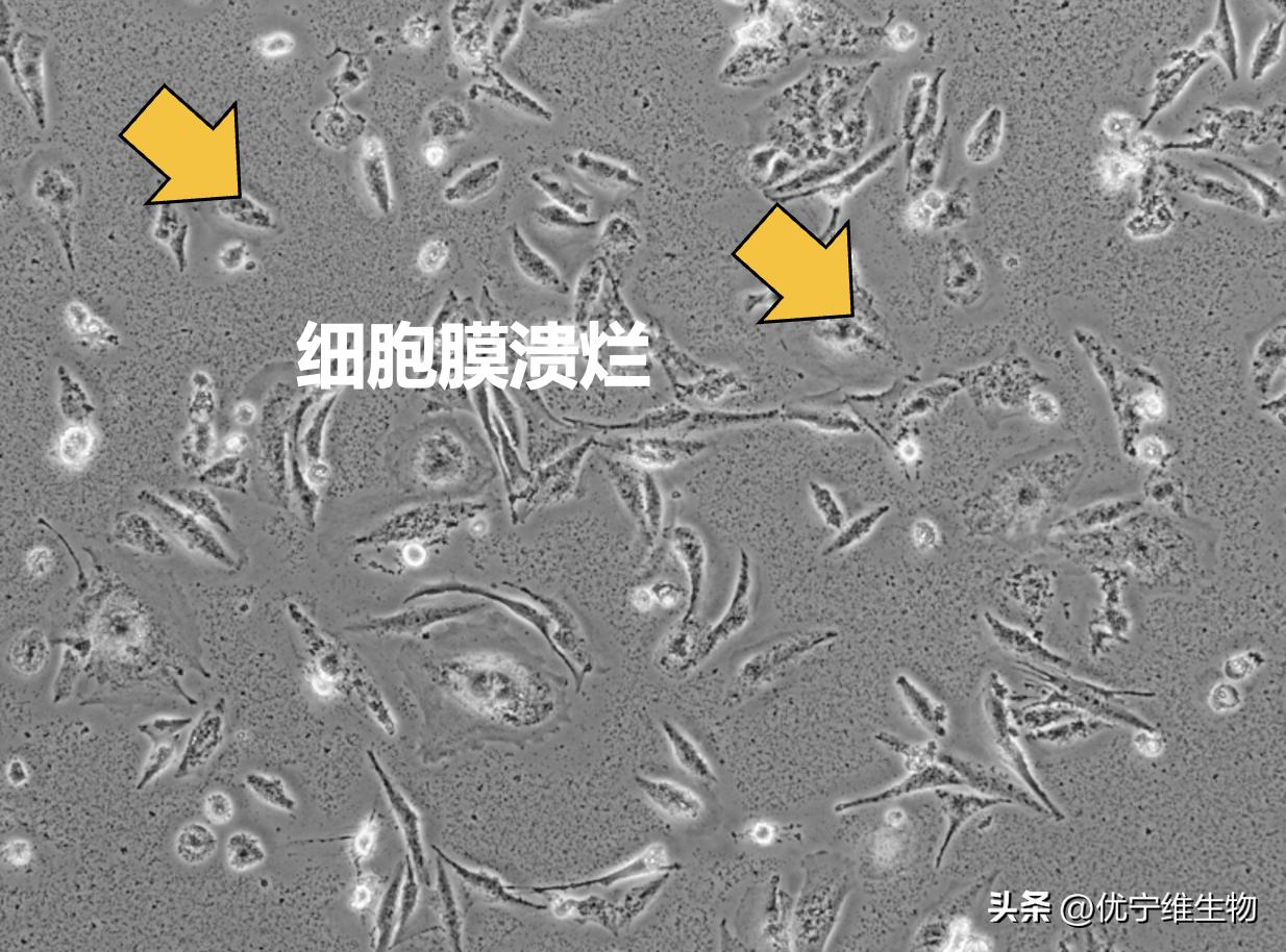 细菌识别最简单的方法,细菌的培养与鉴定操作步骤