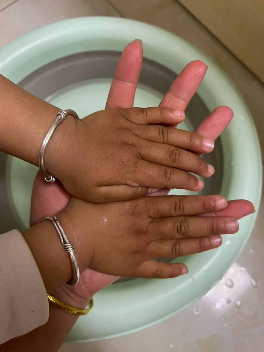 宝宝越养越黑了怎么回事,孩子越养越瘦越黑怎么回事