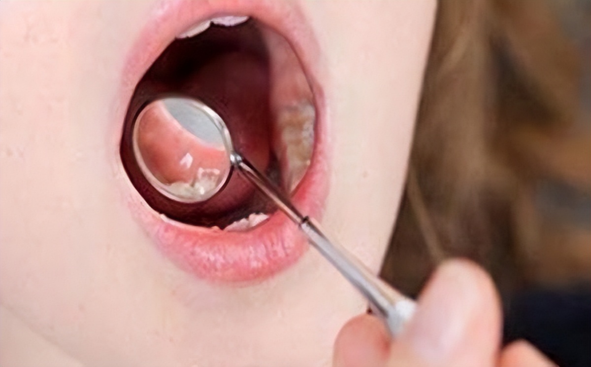 转告家人5种蔬菜比槟榔致癌更高,比槟榔致癌率还高的食物