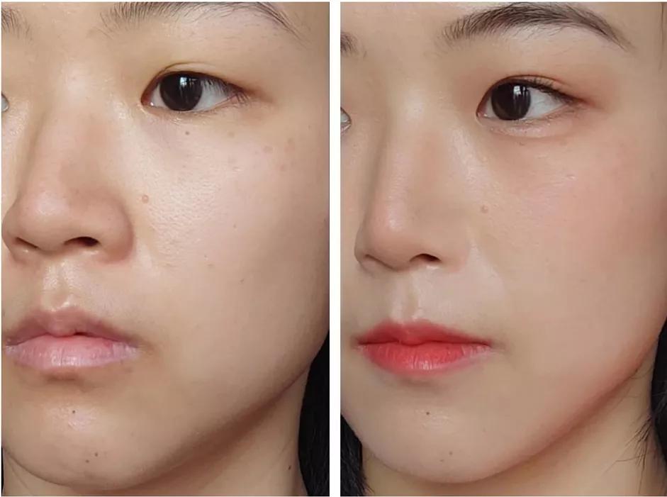 塌鼻梁的变美思路,塌鼻子变美小技巧视频教程