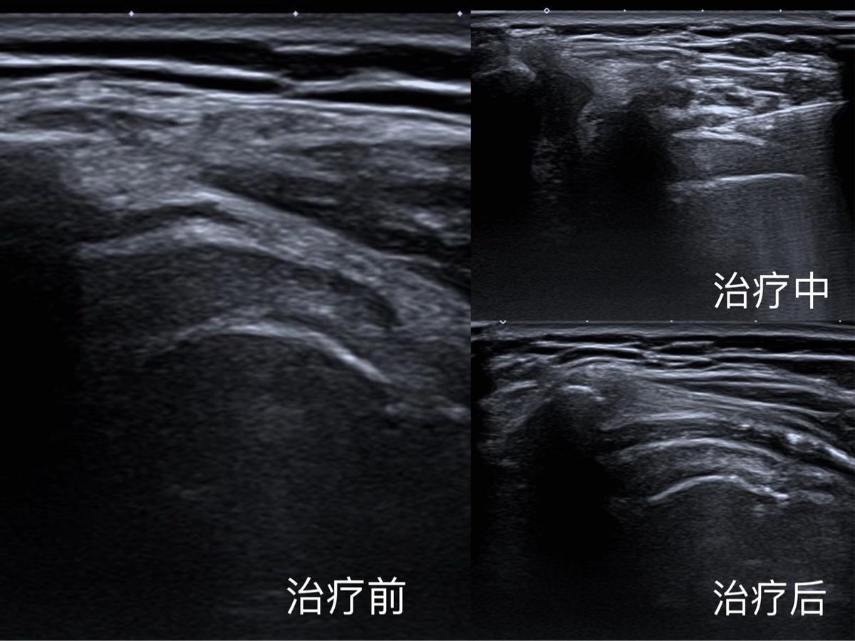 医师节义诊活动新闻报道,哈医大医师节