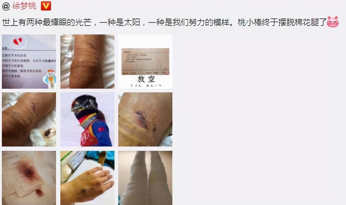 徐梦桃奥运冠军的故事简短,徐梦桃奥运夺冠视频完整版