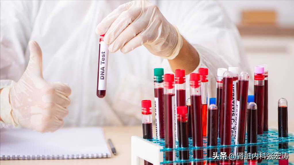 增强ct用造影剂对肾脏影响有多大,增强血管ct检查对人有伤害吗