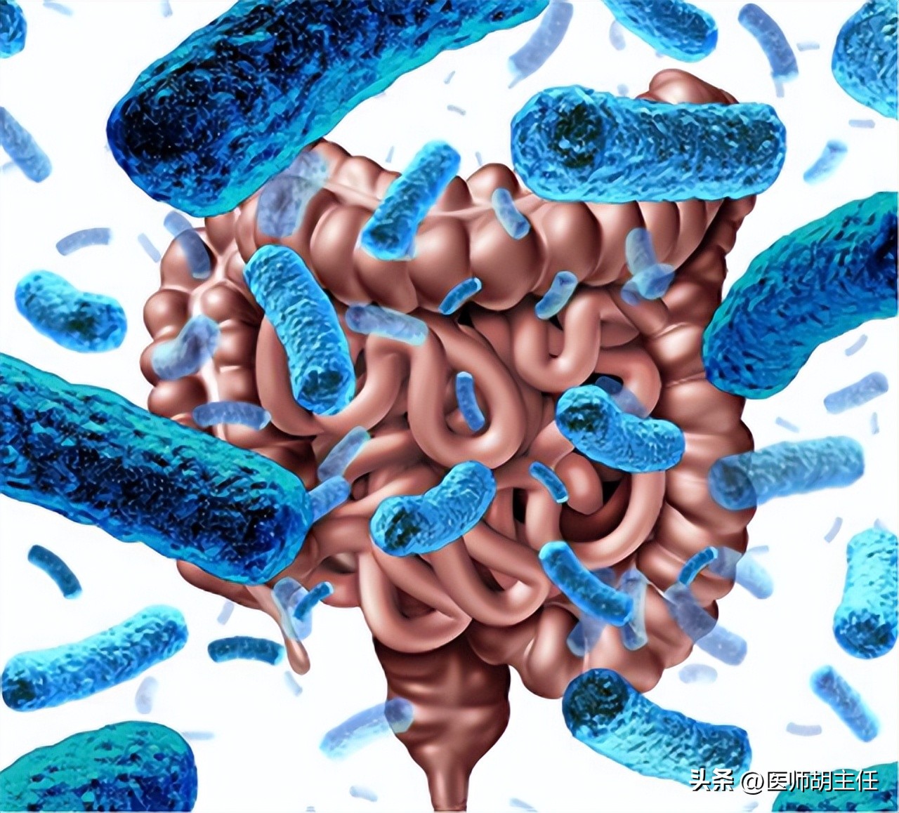 为什么肠道会长息肉,为什么肠道容易长息肉