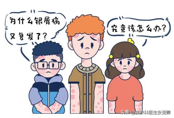 银屑病小腿红肿用什么药,银屑病关节肿痛怎么办