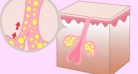怎么护肤皮肤又细又滑又紧致,怎么护肤让皮肤更细滑一点