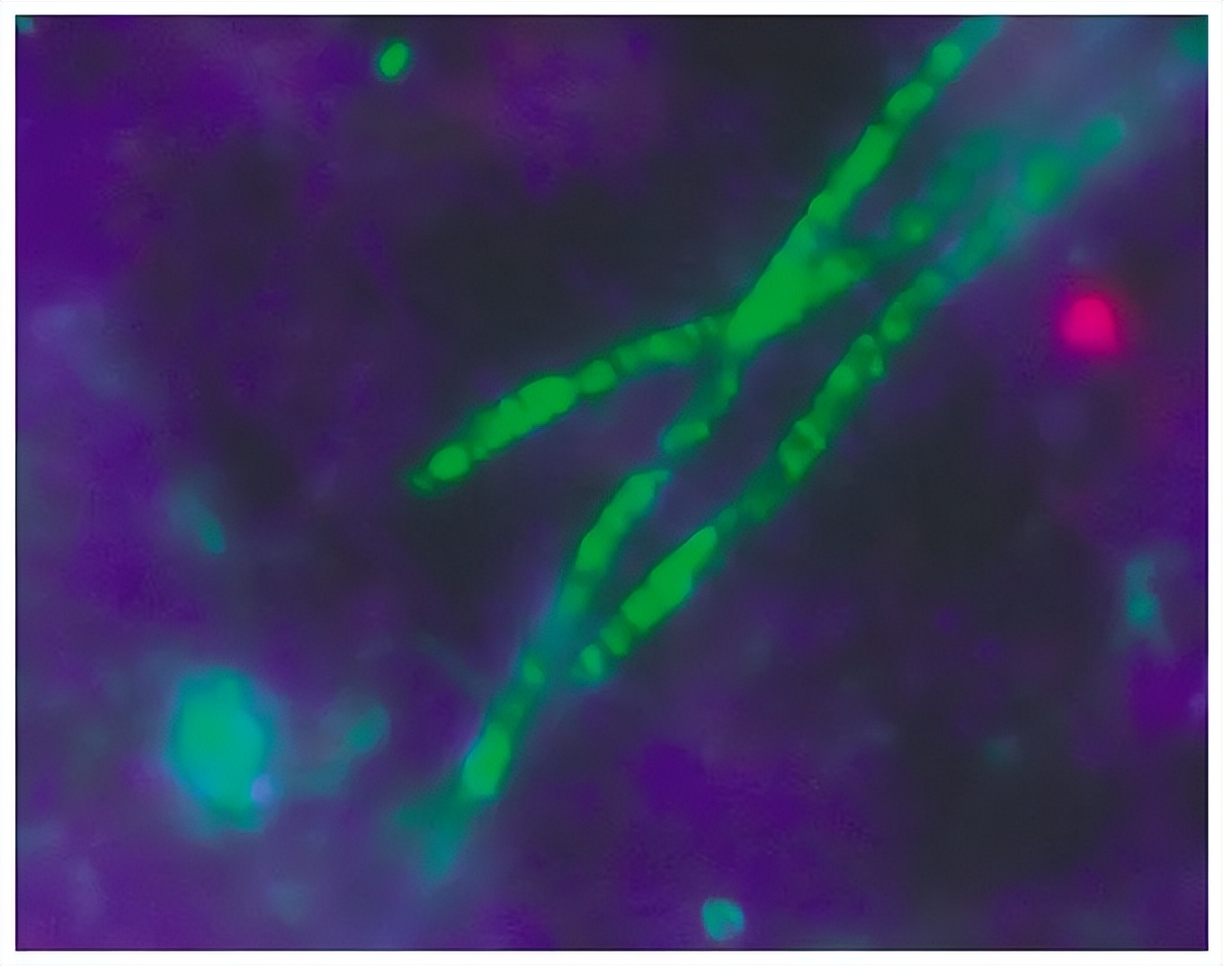 肠道菌群由哪些细菌组成,深度分析肠道细菌