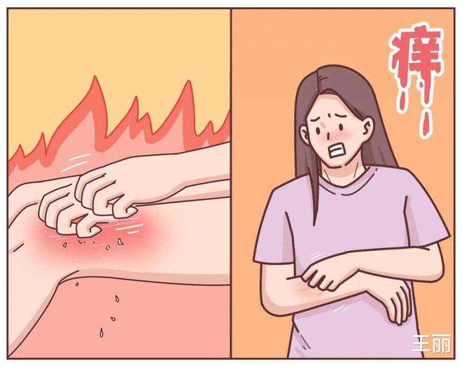 皮肤瘙痒，两味中药来帮你