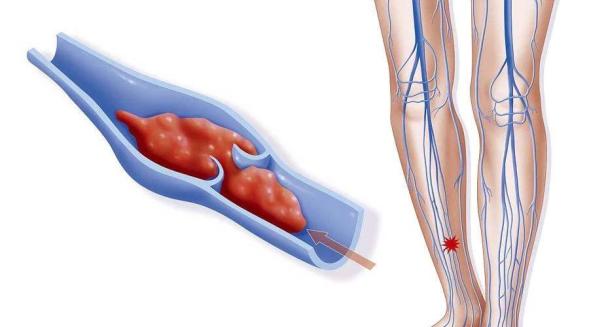 术后几年疼痛难忍怎么缓解,术后太痛怎么办