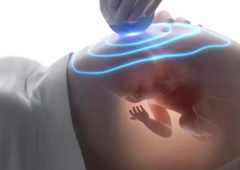 妊娠糖尿病孕晚期怎么做,孕妇妊娠糖尿病嘴好馋