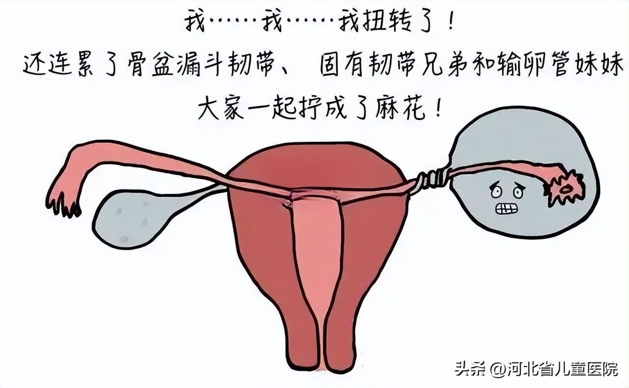 女性附件扭转病因,附件扭转原因