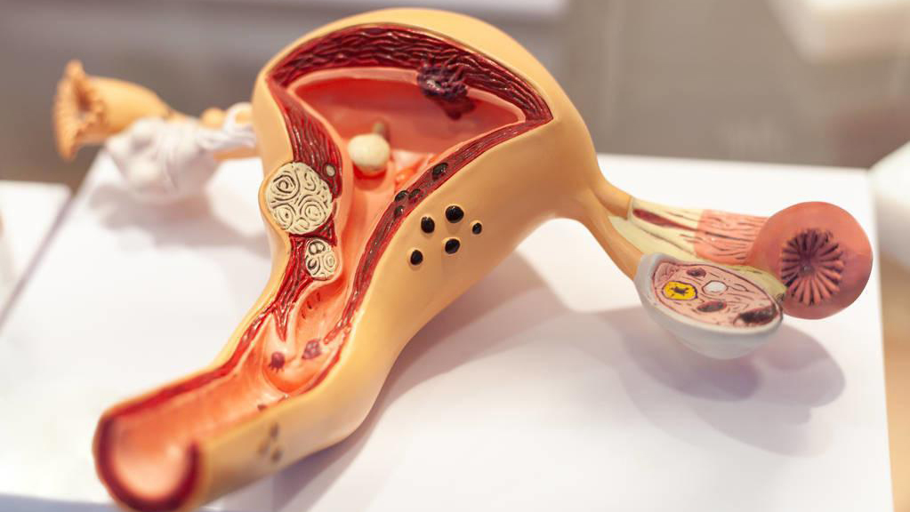 卵巢早衰和内分泌失调的关系,卵巢功能早衰和内分泌失调一样吗