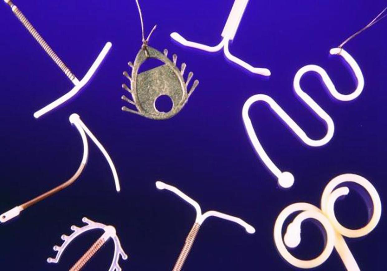 取节育环真的有危险吗,节育环长肉里还取的下来么