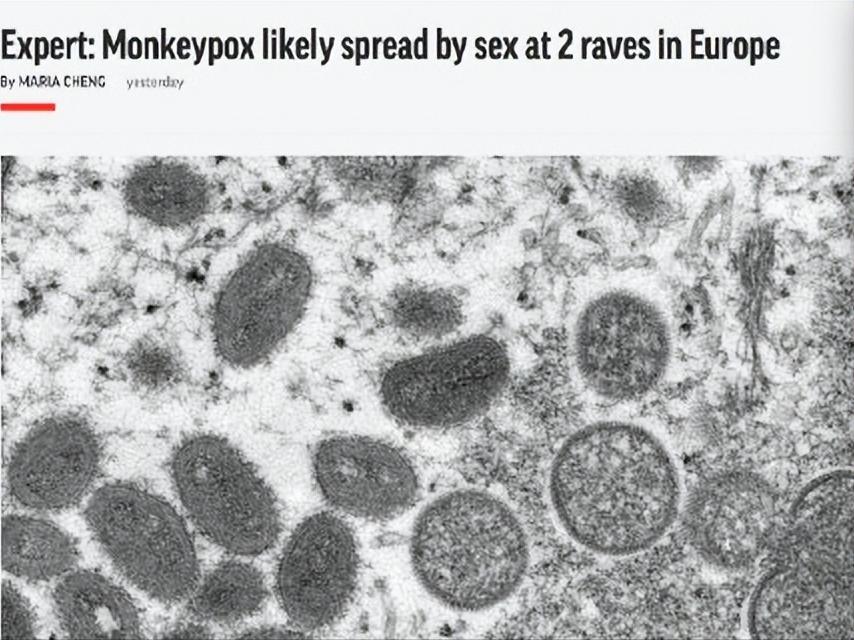 全球确诊38例猴痘病例,美国猴痘确诊病例数居全球首位