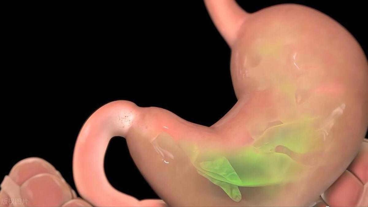 丈夫一天要打100多个嗝，还有难闻的气味，晚上打嗝把妻子臭醒了