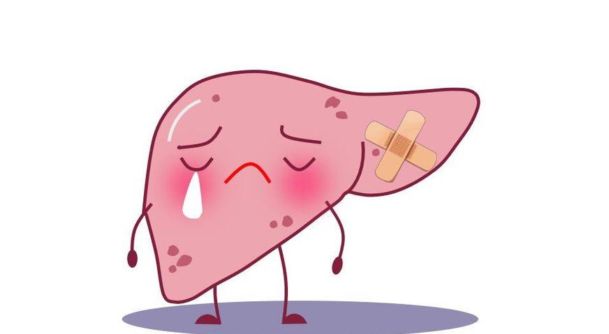 有红点很可能是肝病恶化了,出现这些红点可能是肝硬化