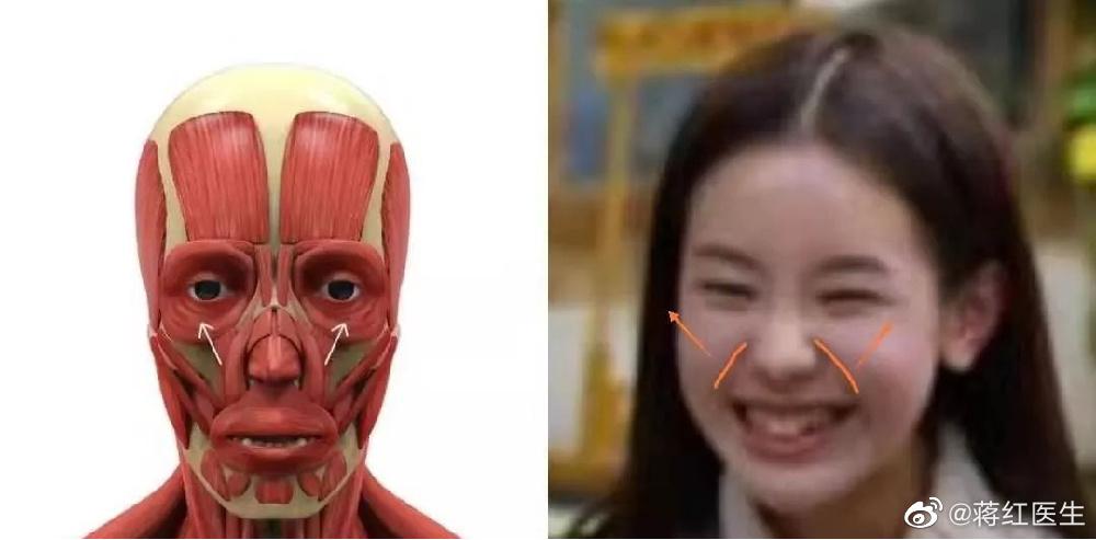 川字纹法令纹最好治疗方法,35岁法令纹类型