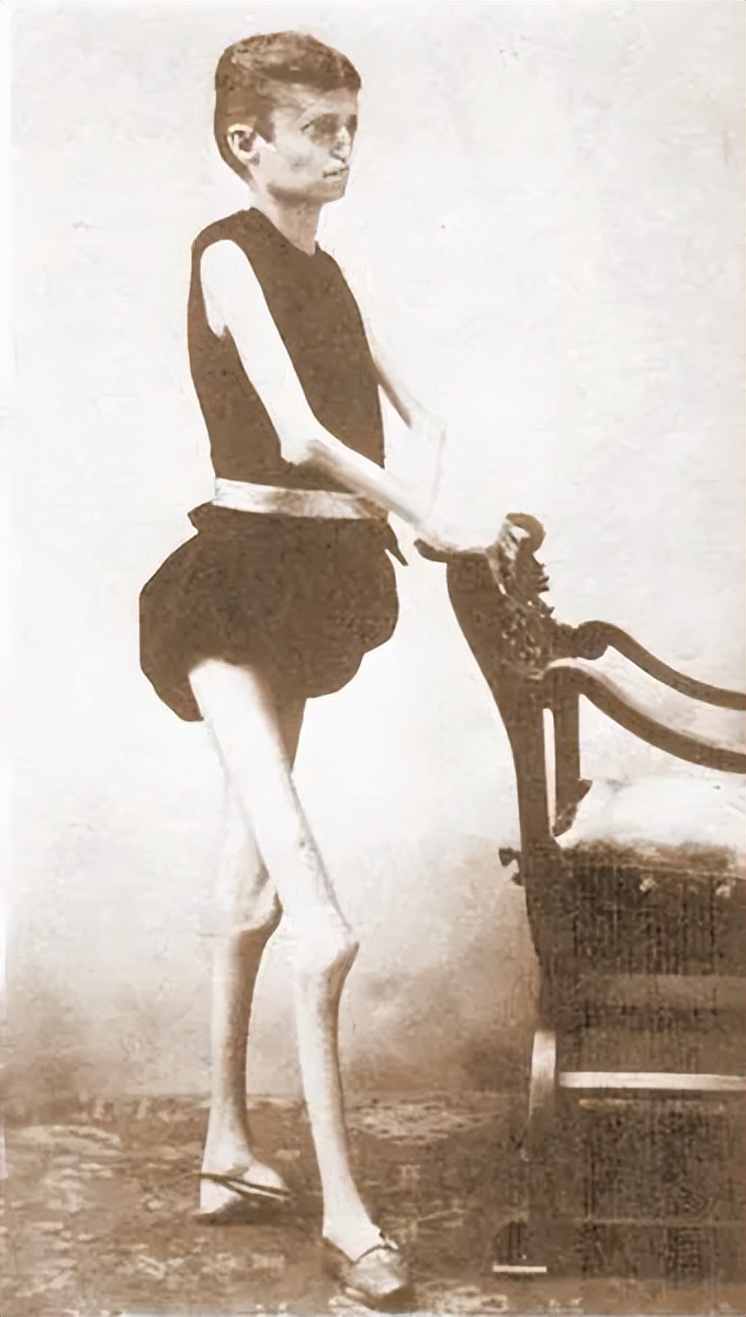 克劳德·安布罗斯·修拉：被称为“活着”的骷髅