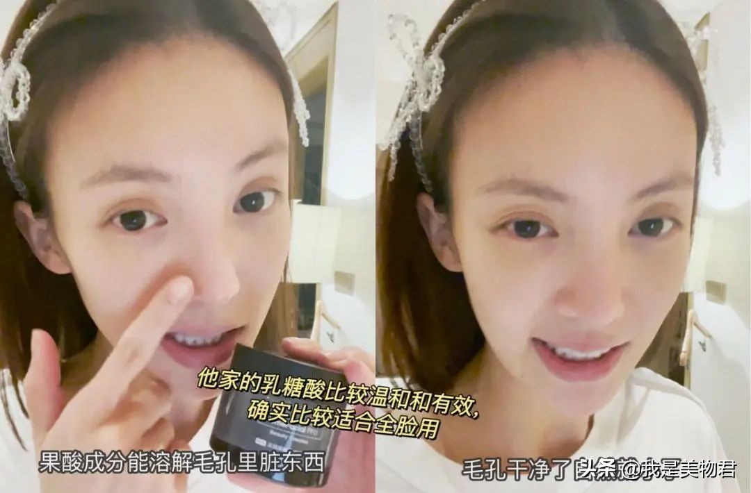 毛孔堵塞闭口粉刺怎么去除最有效,毛孔堵塞闭口粉刺怎么消除