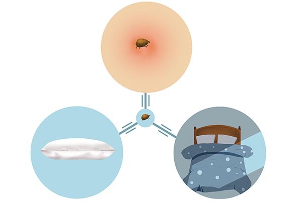 螨虫上身有什么症状,螨虫浑身痒怎么治疗