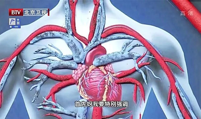 排便用力导致脑出血案例,排便太用力会有多危险需引起警惕