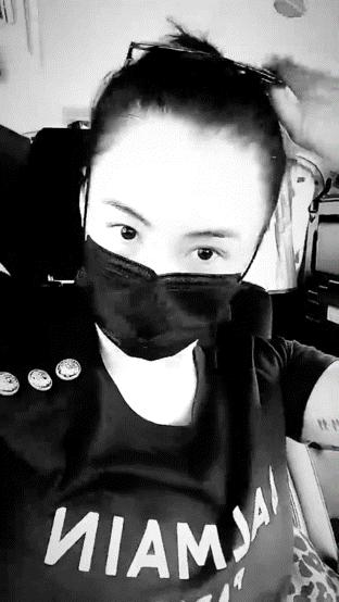 张柏芝被宠物狗咬脸,张柏芝小儿子受伤