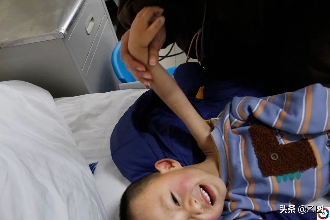 3岁孩子基因突变有什么症状,男童基因变异3年后