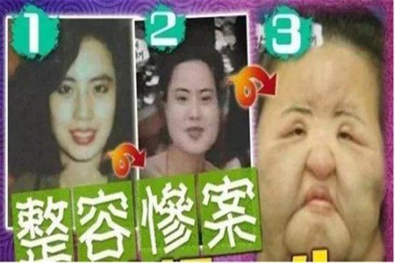 韩国“电风扇大妈”：为变美整容，给自己注射大豆油，用石蜡填充