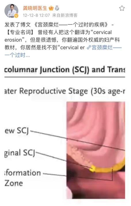 “没有*生活性**，也会得妇科病”｜一位资深妇科医生的忠告