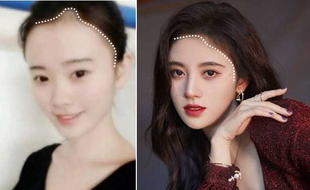 女明星也秃头？杨紫鞠婧祎全靠小心机，杨幂没刘海就是“光明顶”