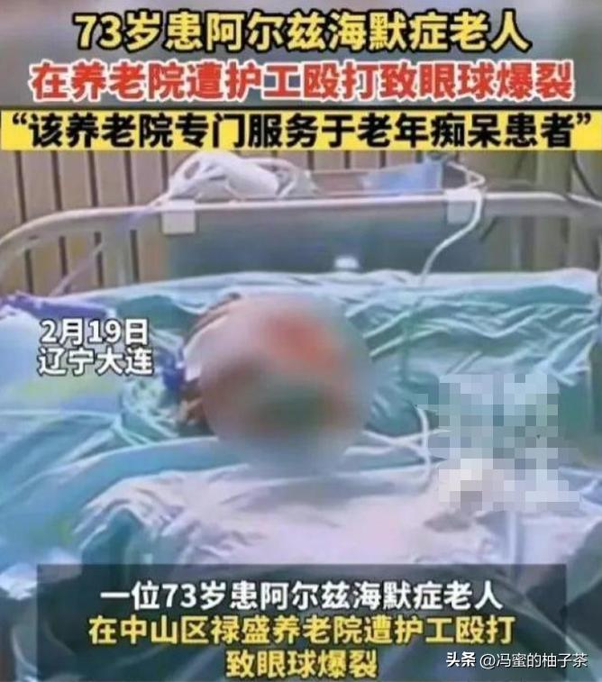 73岁老兵被护工打爆眼球第三集,73岁老人被护工打裂眼球后续