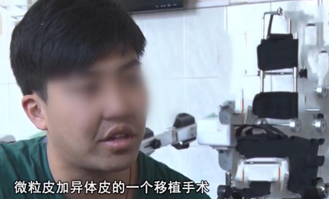 河南男子掉锅烫伤爸妈植皮救儿子,河南男子掉入油锅后续