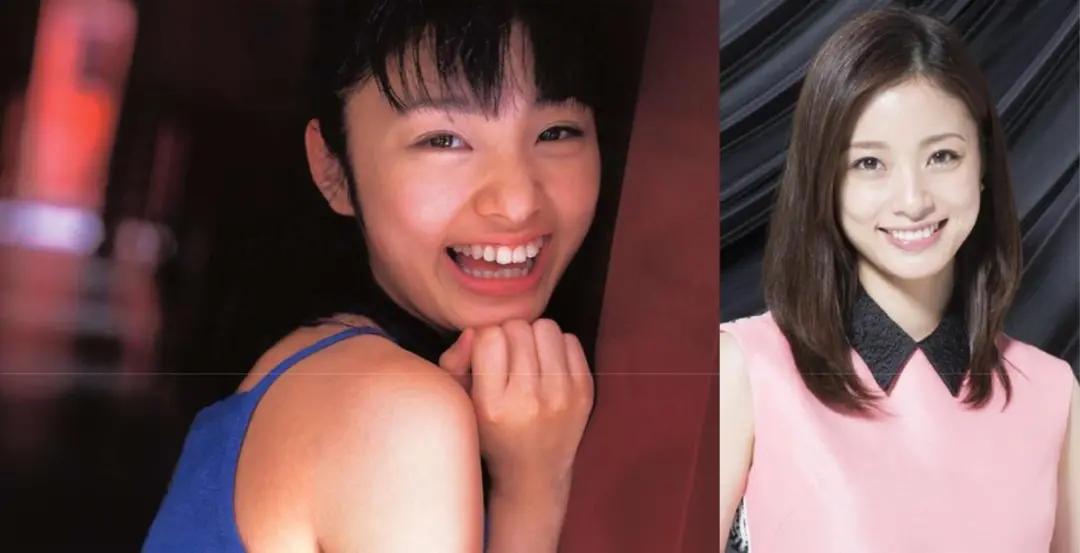 日本整牙的明星,日本整牙明星