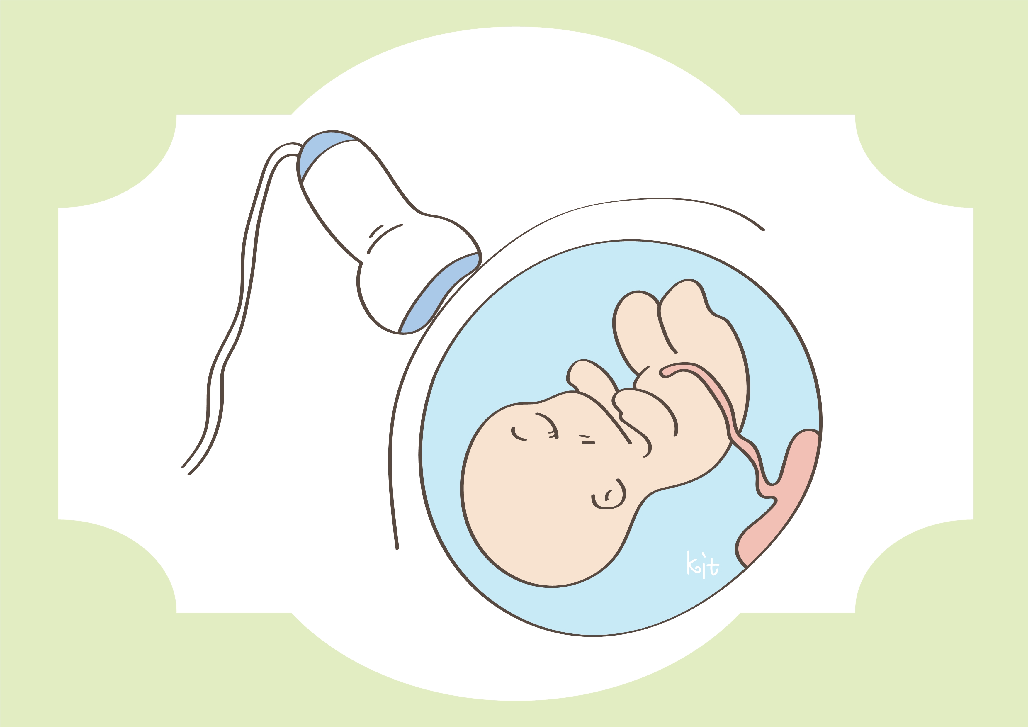 剖宫产是最好的分娩方式吗,剖宫产的弊端的参考文献