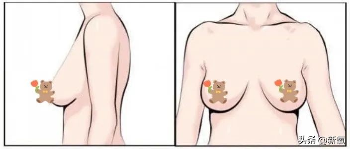 胸部略微下垂,胸部有时变大有时变小怎么回事